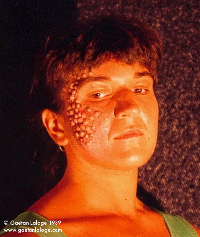 Pustulous_Makeup_Test