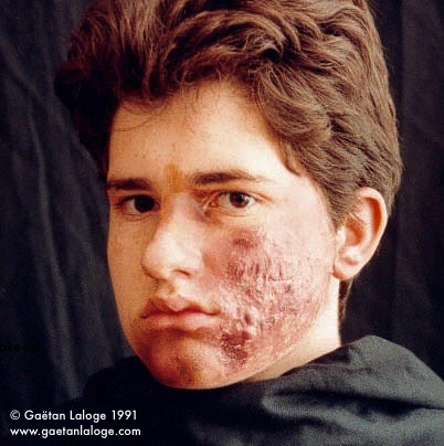 Skin_Problems_Make up